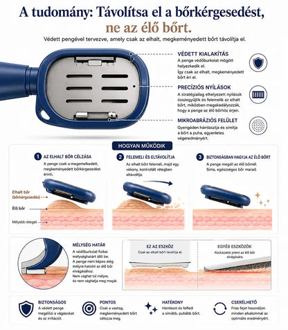 Egy lépésben működő bőrkeményedés-eltávolító